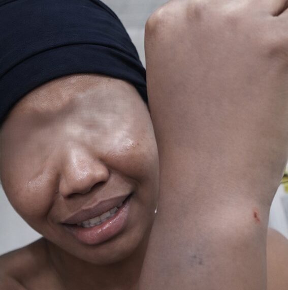 BÉNINOISES AU KOWEÏT : UNE VICTIME BATTUE A SANG LANCE UN APPEL